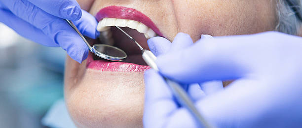 Best Emergency Treatment for Dental Infections or Abscesses in Monroeville, IN