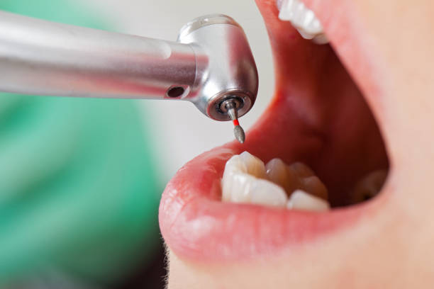 Best Weekend Emergency Dentist in Monroeville, IN